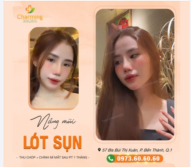 Nàng khách đã quyết định tân trang nhan sắc với Charming và trông thật lung linh