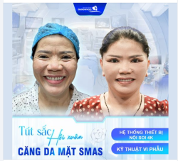 CĂNG DA MẶT SMAS NỘI SOI VI PHẪU