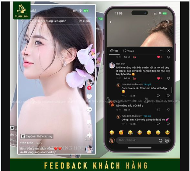 Feedback mũi sau 6 năm - Bền đẹp xuất sắc!!