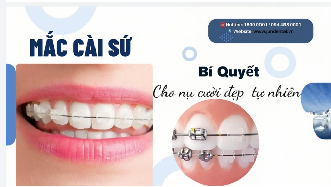 MẮC CÀI SỨ - BÍ QUYẾT CHO NỤ CƯỜI ĐẸP TỰ NHIÊN