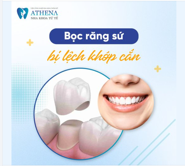 Bọc răng sứ có bị lệch khớp cắn không?