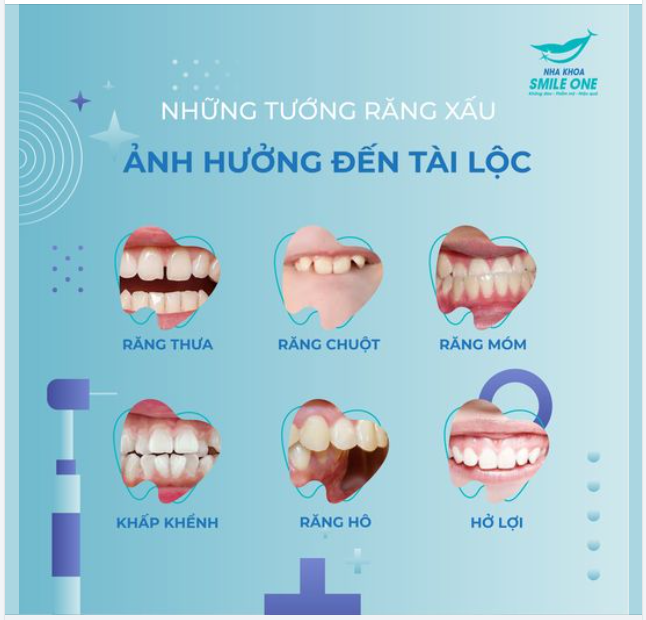NHỮNG TƯỚNG RĂNG XẤU ẢNH HƯỞNG TỚI TÀI LỘC