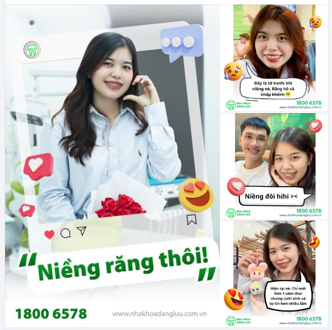 Bắt Đầu Hành Trình Niềng Răng Viết Nên Câu Chuyện Nụ Cười Của Chính Mình