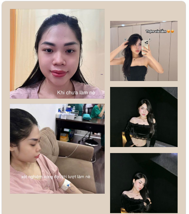 "Biết nâng mũi xinh như vậy chắc em nâng từ lâu rồi. Ai cũng hỏi nâng ở đâu mà dáng mũi tự nhiên trộm vía quá, em giới thiệu qua Tấm liền".