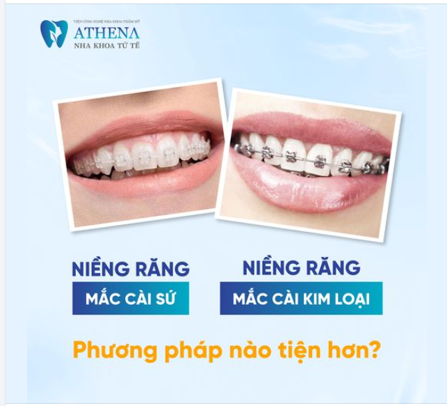 Niềng răng mắc cài sứ và mắc cài kim loại phương pháp nào tiện hơn