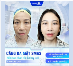 CĂNG DA MẶT SMAS NỘI SOI VI PHẪU KIẾN TẠO NHAN SẮC KHÔNG TUỔI