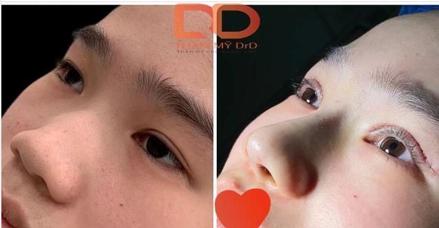 Nếu tin vào phong thuỷ thì chắc chiếc góc nghiêng mới này sẽ làm thay đổi hẳn vận mệnh của một con người.