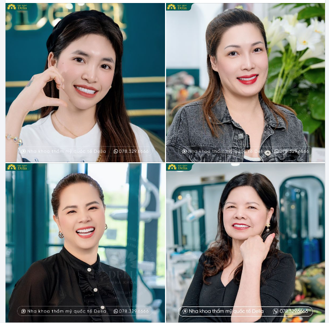 NỤ CƯỜI DELIA MANG DẤU ẤN CÁ NHÂN CỦA CHỦ SỞ HỮU