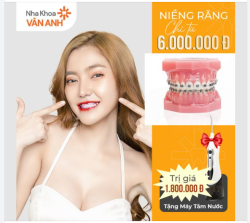 QUẾ VÕ - NIỀNG RĂNG TRẢ GÓP TỪ 6 TRIỆU