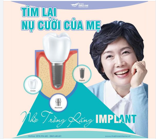 TÌM LẠI NỤ CƯỜI CỦA MẸ NHỜ TRỒNG RĂNG IMPLANT