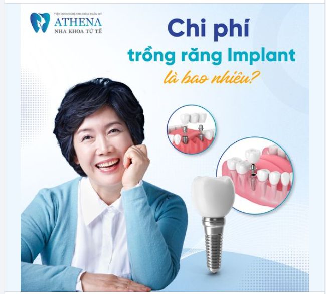 Chi phí trồng răng có quá đắt