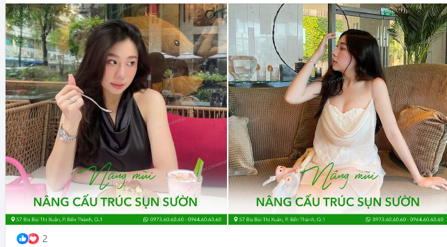 Thêm một nàng công chúa lựa chọn nâng mũi cấu trúc sụn sườn cùng Charming để trở nên rạng rỡ hơn