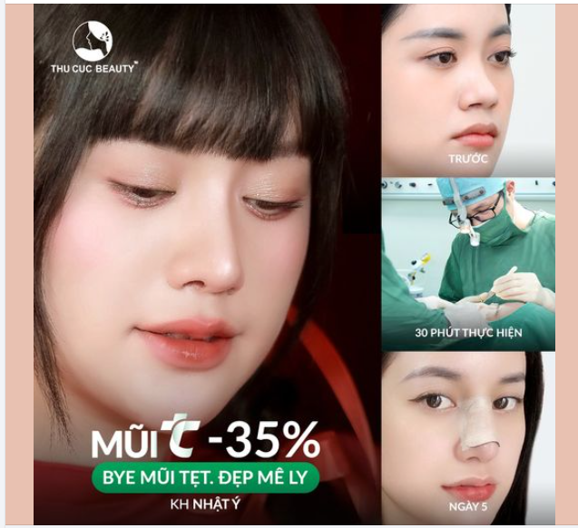 Nâng mũi ngay đi để được hưởng ưu đãi bạn ơi