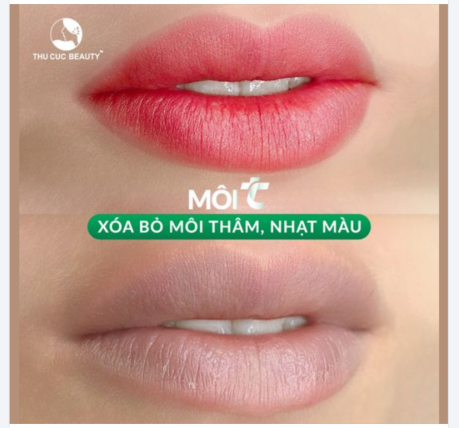 Sử dụng mực organic Biotouch được FDA Hoa Kỳ chứng nhận. Kỹ thuật chính xác. Đẹp ngay sau làm. Môi căng mọng. Lên tone tự nhiên