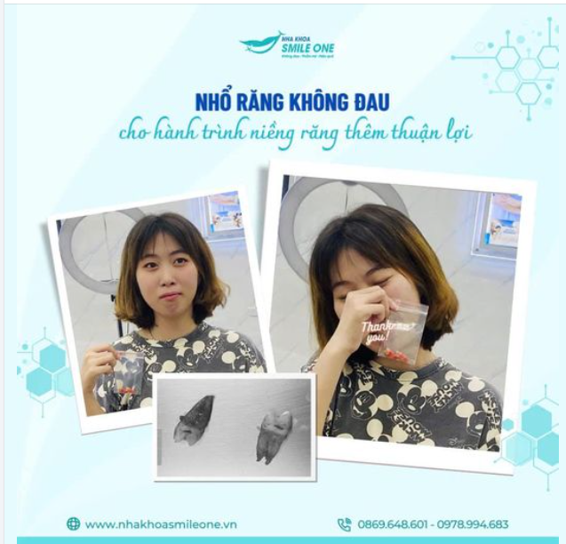 LUÔN PHẢI ÔM MÁ VÌ CHIẾC RĂNG KHÔN GÂY ĐAU NHỨC