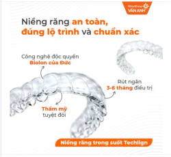 TECHLIGN - SỨC MẠNH ĐẰNG SAU CÔNG NGHỆ ĐỘC QUYỀN