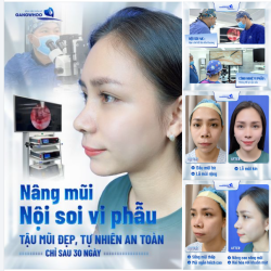 NÂNG MŨI NỘI SOI VI PHẪU TẬU MŨI ĐẸP TỰ NHIÊN AN TOÀN SAU 30 NGÀY