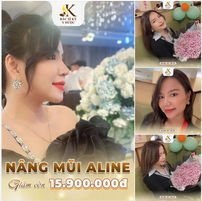 BIẾT TIN NÂNG MŨI ALINE GIÁ 15TR9 Đặt lịch để có diện mạo mới