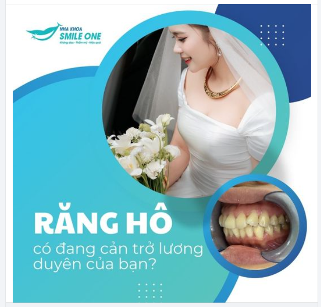 RĂNG HÔ CÓ ĐANG CẢN TRỞ LƯƠNG DUYÊN CỦA BẠN?