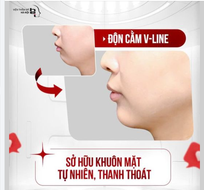ĐỘN CẰM VLINE kiến tạo VẺ ĐẸP THANH TÚ