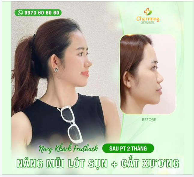 Trước mắt mọi người đây là một nàng khách của Charming siêu xinh xắn