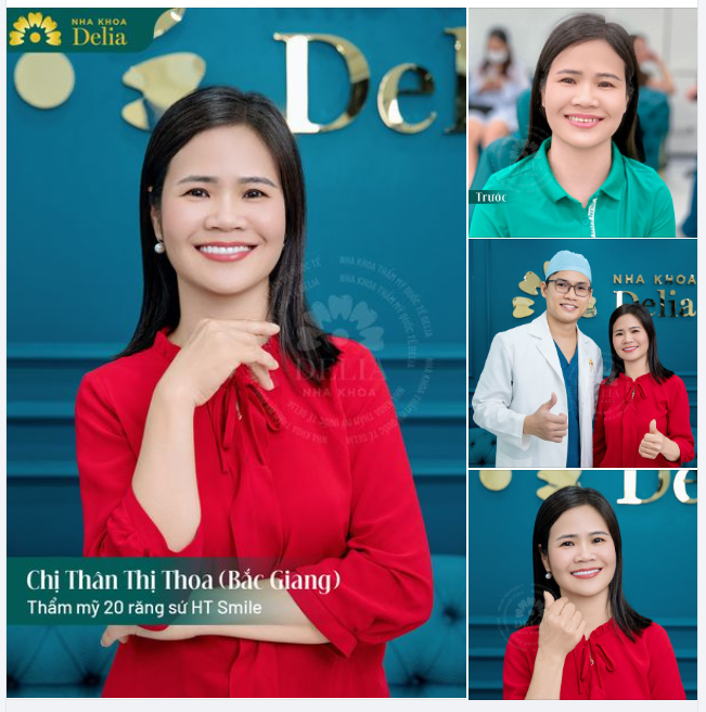 TRẺ RA 5 TUỔI SAU LÀM RĂNG SỨ TẠI NHA KHOA DELIA