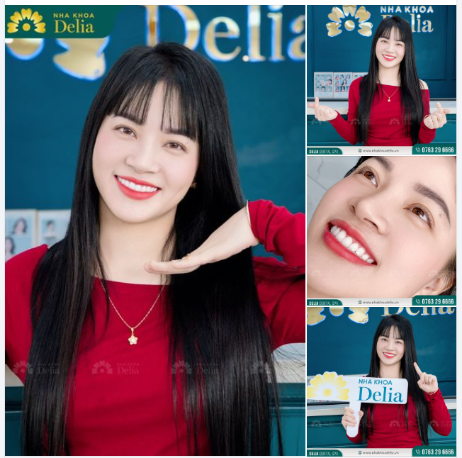 Nụ cười tỏa nắng của chị Tú Anh đã khiến bạn say mê và đặt lịch đến Delia chưa!?