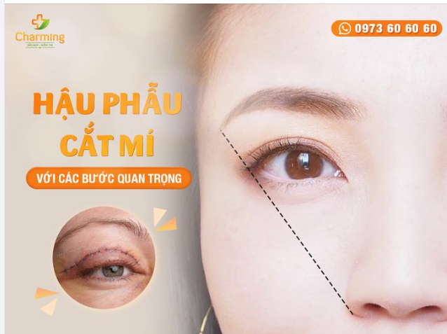 CHĂM SÓC SAU KHI CẮT MÍ - BƯỚC QUAN TRỌNG KHÔNG THỂ BỎ QUA