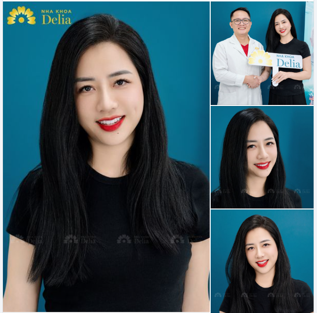 NỤ CƯỜI TỎA SÁNG, GIỮ TRỌN NÉT RIÊNG