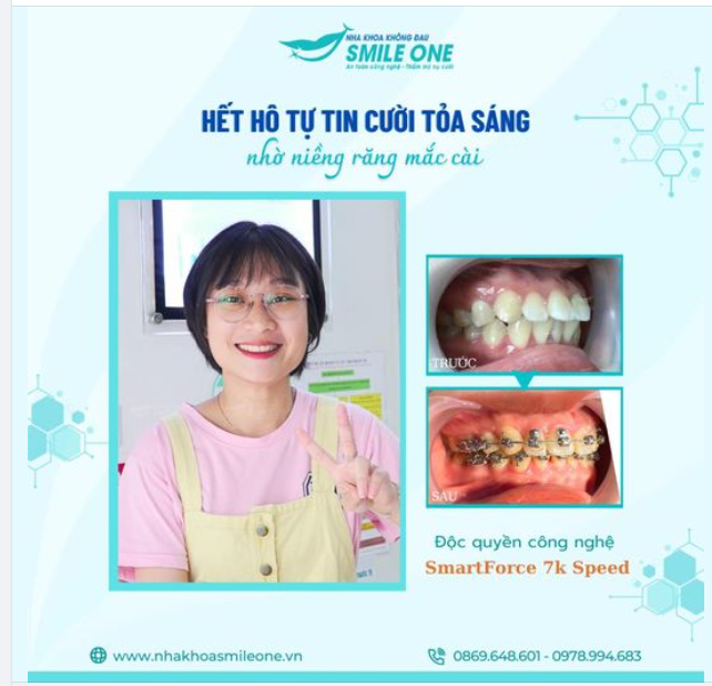 HẾT HÔ TỰ TIN CƯỜI TỎA SÁNG
