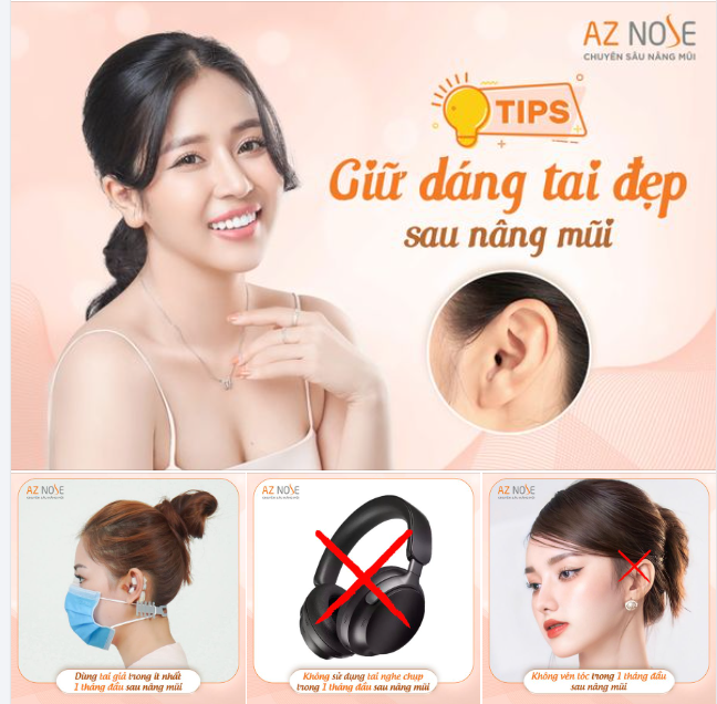 Bạn đã biết cách giữ dáng tai đẹp sau nâng mũi