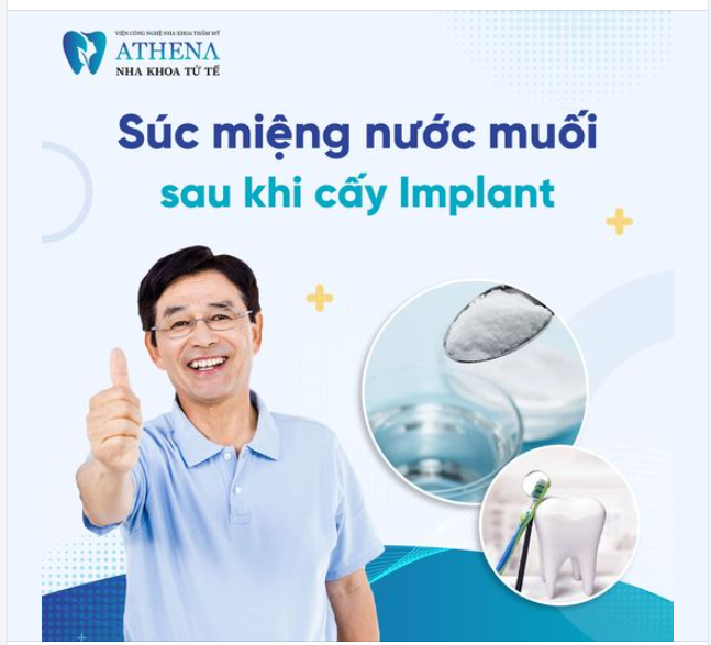 Sau khi trồng răng implant, chăm sóc răng miệng đúng cách là yếu tố quyết định đến thành công và thời gian hồi phục của quá trình điều trị.