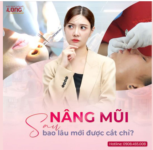 NÂNG MŨI SAU BAO LÂU MỚI ĐƯỢC CẮT CHỈ?