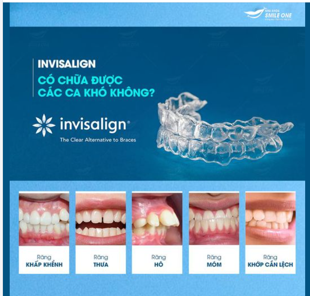 RĂNG XẤU ĐUỔI NHÂN DUYÊN Bạn đã 30 nhưng chưa có mối duyên nào? Lý do là đâu? Răng xấu ư?