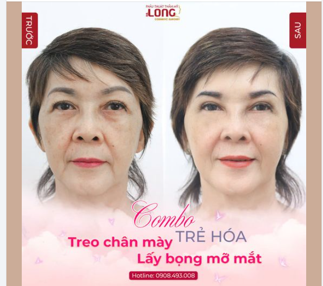 1 CHÚT ĐỔI THAY - TRẺ RA NGAY VÀI TUỔI