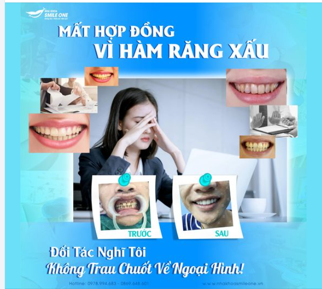 MẤT HỢP ĐỒNG VÌ HÀM RĂNG XẤU