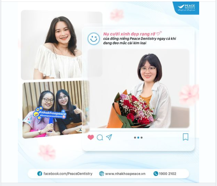 NHỮNG ĐIỀU "ĐỒNG NIỀNG" CẦN LƯU Ý KHI MỚI NIỀNG RĂNG