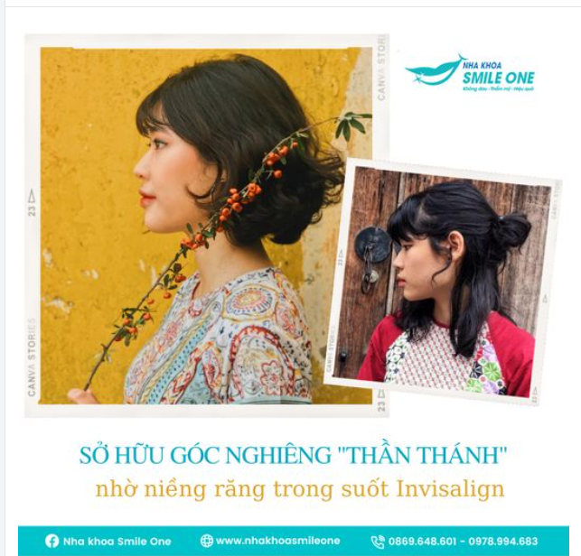SỞ HỮU GÓC NGHIÊNG THẦN THÁNH NHỜ NIỀNG RĂNG TRONG SUỐT INVISALIGN