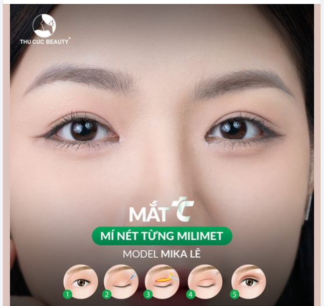 Đến TC tạm biệt mắt một mí sau 15 phút