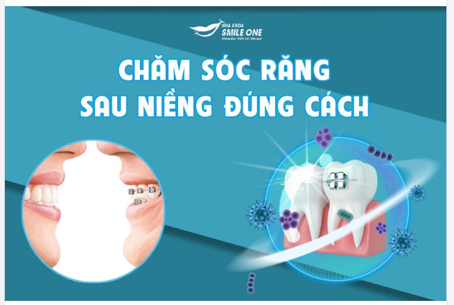 CHĂM SÓC RĂNG SAU NIỀNG ĐÚNG CÁCH
