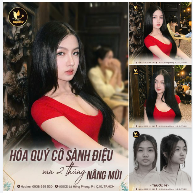 FEEDBACK SANG XỊN MỊN SAU 2 THÁNG NÂNG MŨI CẤU TRÚC