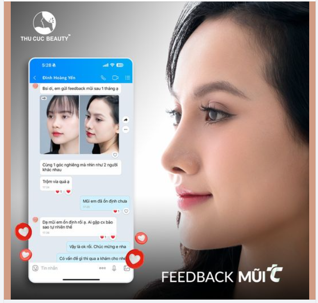 10 suất Mũi TC Giá hời dành tặng cho chị em đăng kí nhanh nhất!!!