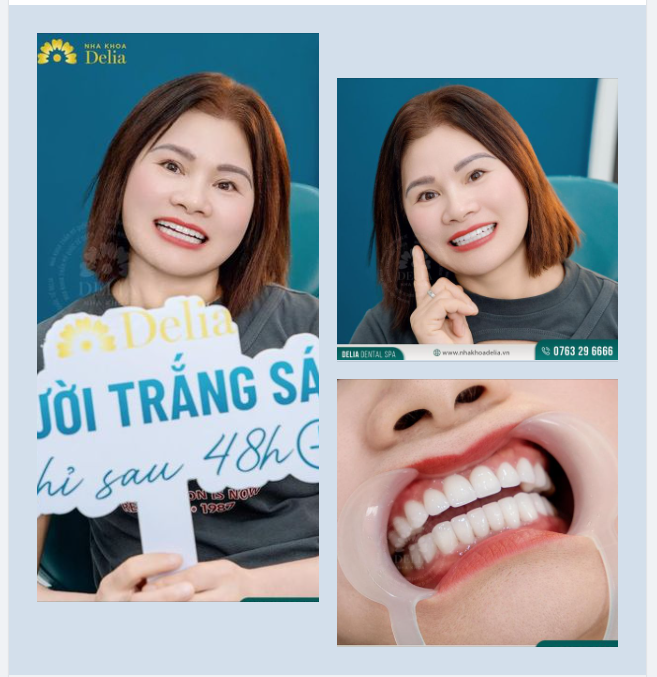 "20 năm nay chị không dám cười, nên cũng quên mất cười thế nào, nhưng mà làm xong chị quá ưng nên giờ chị có thể cười lại rồi" - Chị Nguyễn Thị Đào chia sẻ.