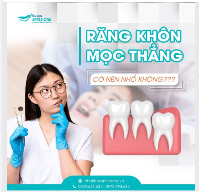 RĂNG KHÔN MỌC THẲNG CÓ NÊN NHỔ KHÔNG?