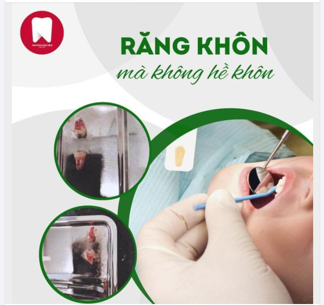 RĂNG KHÔN MÀ LẠI KHÔNG HỀ KHÔN