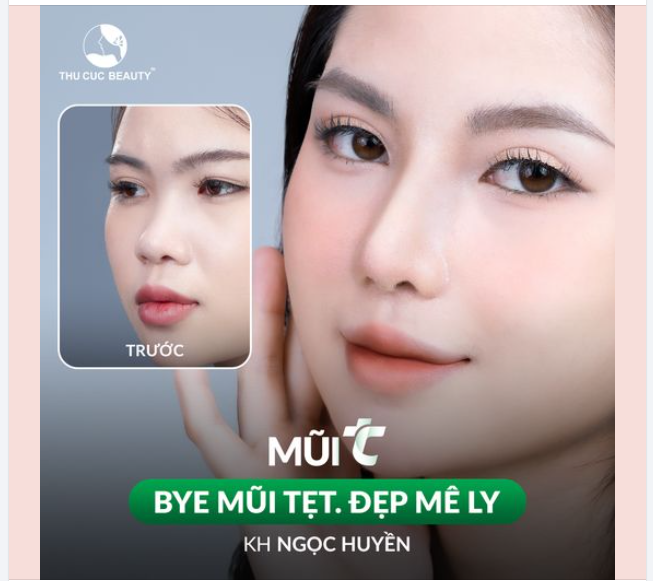 CMT tình trạng mũi thấp, tẹt, hếch... để nhận tư vấn trực tiếp từ Bác sĩ