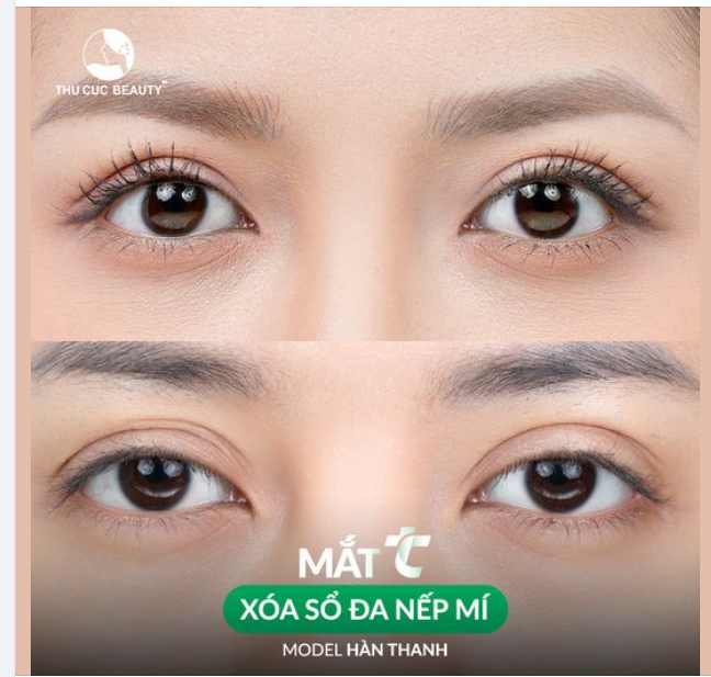 15P để say "bye" nhiều nếp mí hay 15 phút make up mỗi ngày?