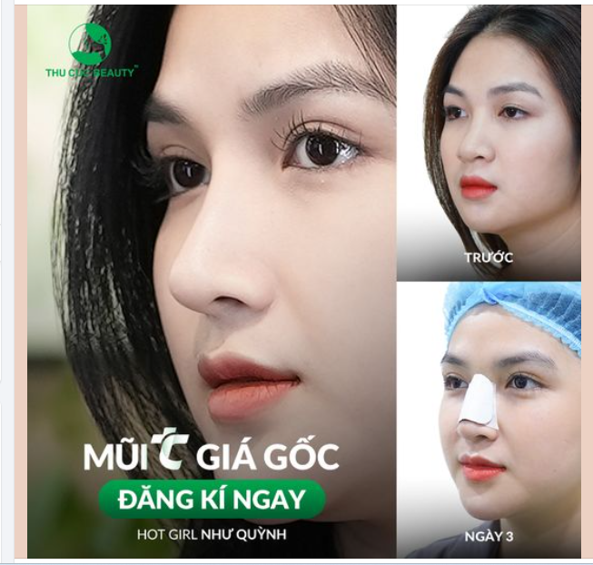 Không nhận ra chiếc mũi của mình nữa