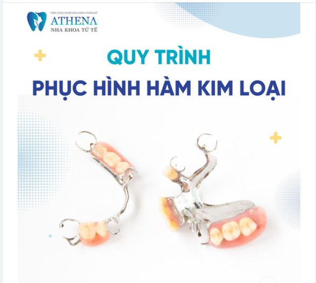 Quy trình phục hình hàm tháo lắp kim loại tại Nha Khoa ATHENA