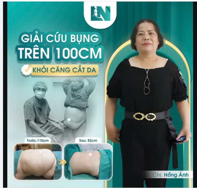 KHÔNG CĂNG CẮT DA VẬY LÀM CÁCH NÀO ĐỂ GIẢI CỨU VÒNG EO 110CM